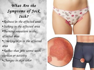a-complete-guide-to-Treating-Jock-Itch