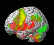 brain