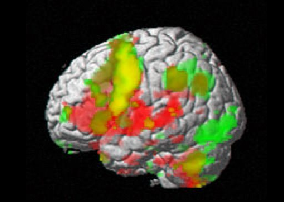 brain2