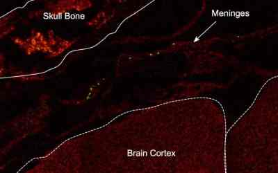 GI tract bacteria help decrease stroke