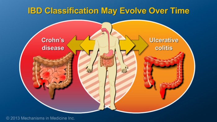 Wellness Wednesday: What is IBD? - GI for Kids