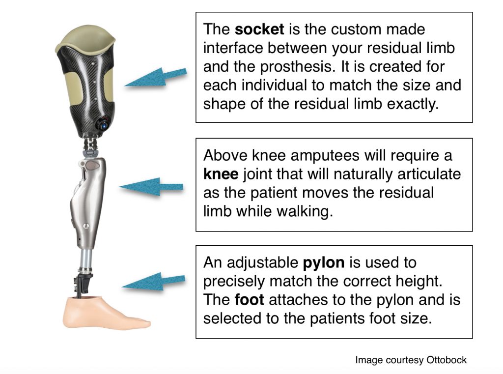 Prosthetic Overview Dream Team Prosthetics LLC