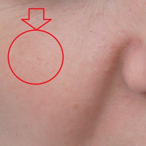 Waxy skin forever... Fujifilm X System / SLR Talk Forum Digital