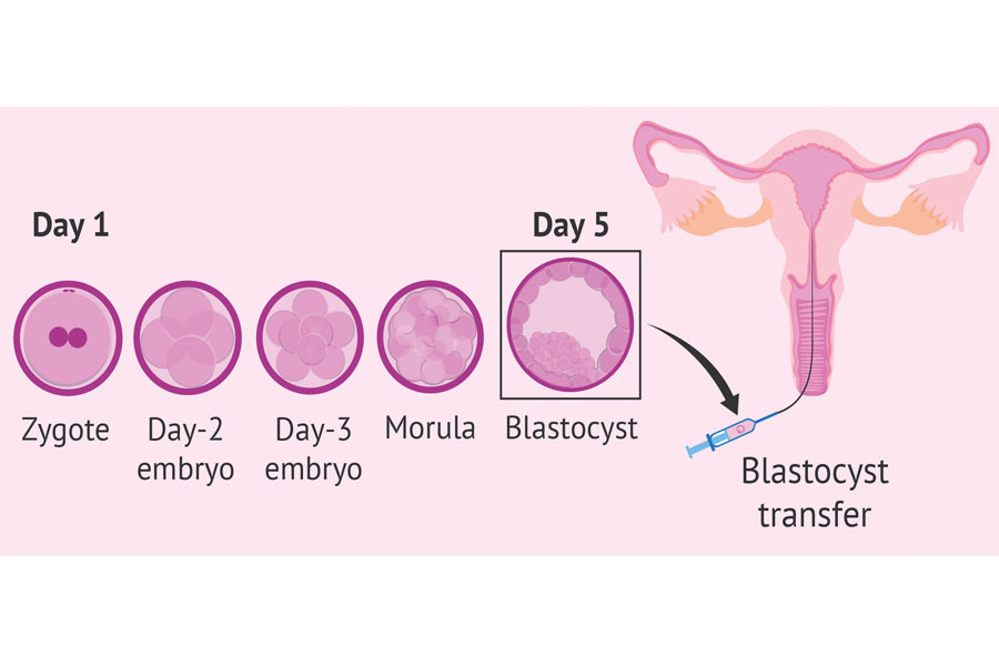 Fertility Simplified