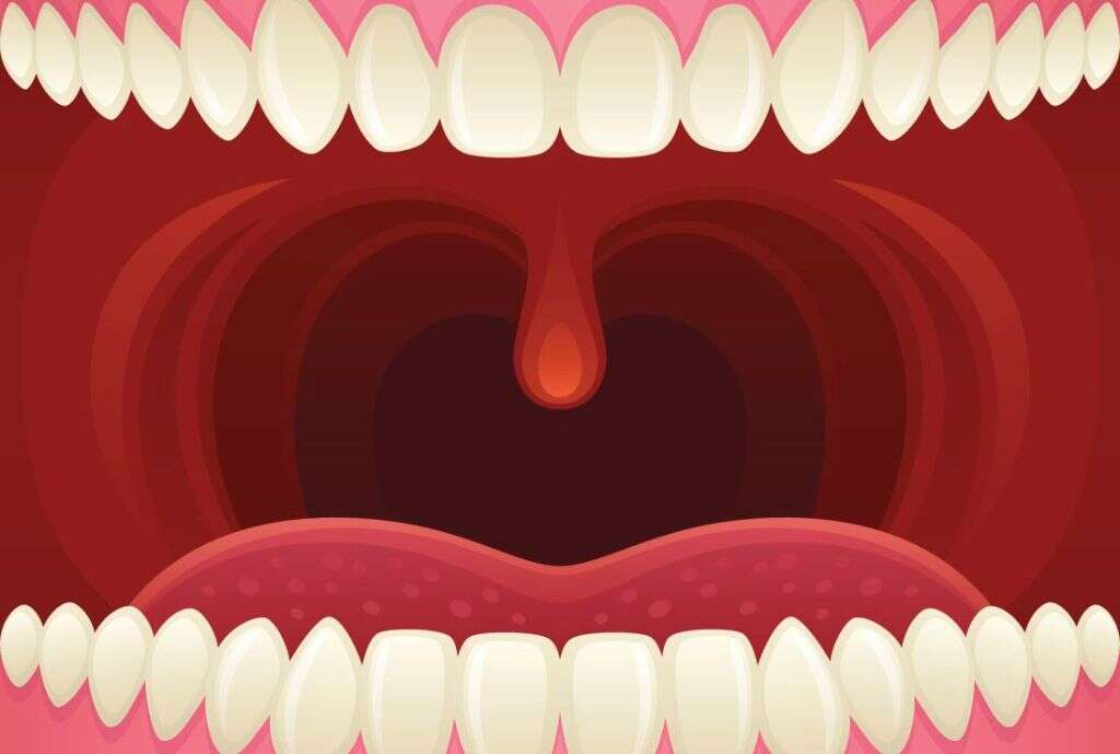 Tonsils What Do Tonsils Do?