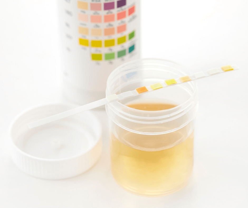 What Can Cause a False Positive on a Drug Screening Test? 12 Panel Now