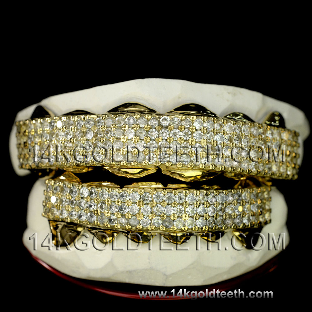 Iced Out Yellow Gold Teeth Grillz IC 40006