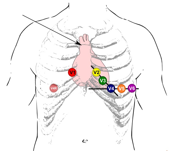Assisting The Paramedic Training Course First Aid