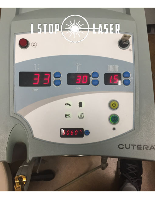Cutera CoolGlide for Sale | Deep Discounts | 1 Stop Laser