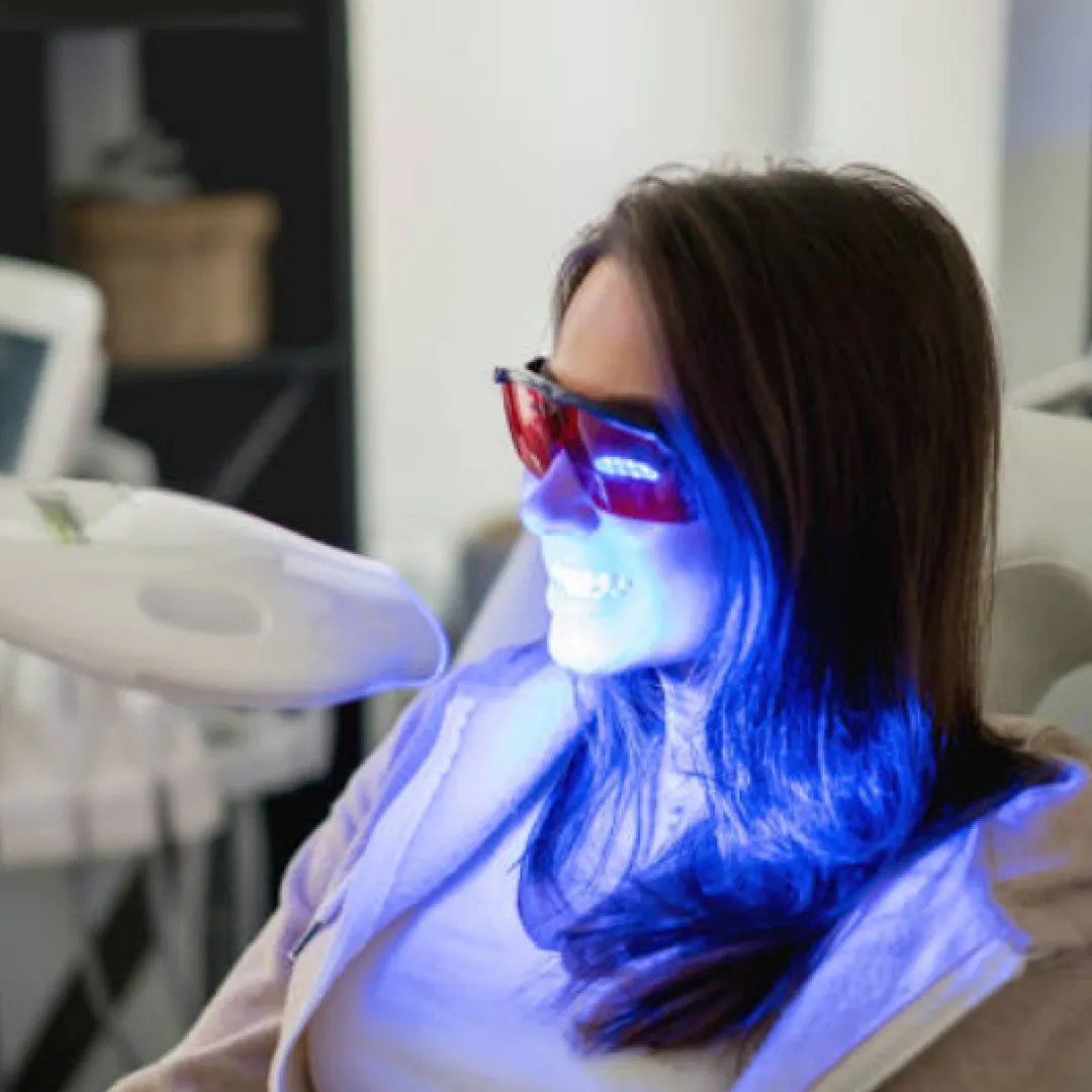 Teeth Whitening Services in NYC 212 Dental Care