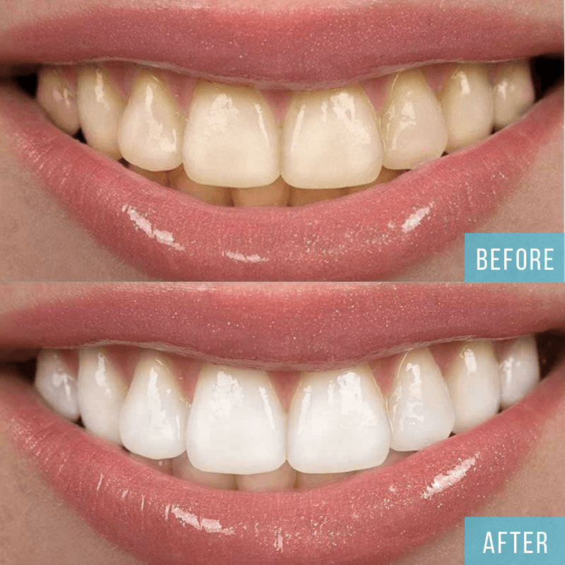 Cosmetic Dental Services in NYC 212 Dental Care