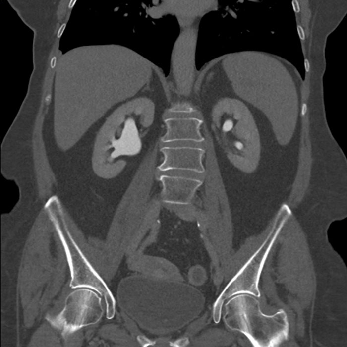 21st Century Radiology & Imaging