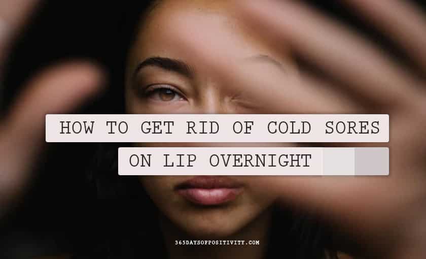 How To Get Rid of Cold Sores On Lip Overnight Daily Inspiration For A Positive Life