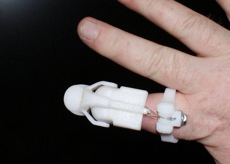 Reno Man 3D Prints Himself a Prosthetic Fingertip using an UP! Mini
