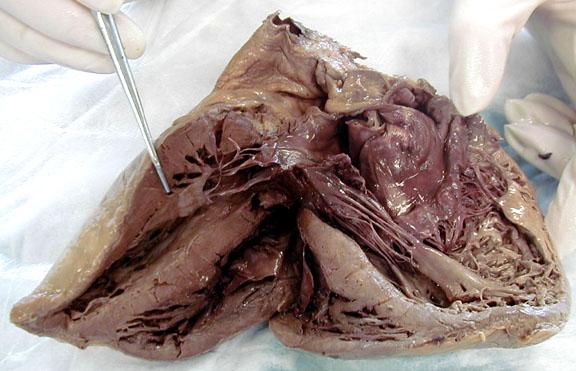 Scientists Use 3D Printing to Create A Patch of Beating Heart Cells