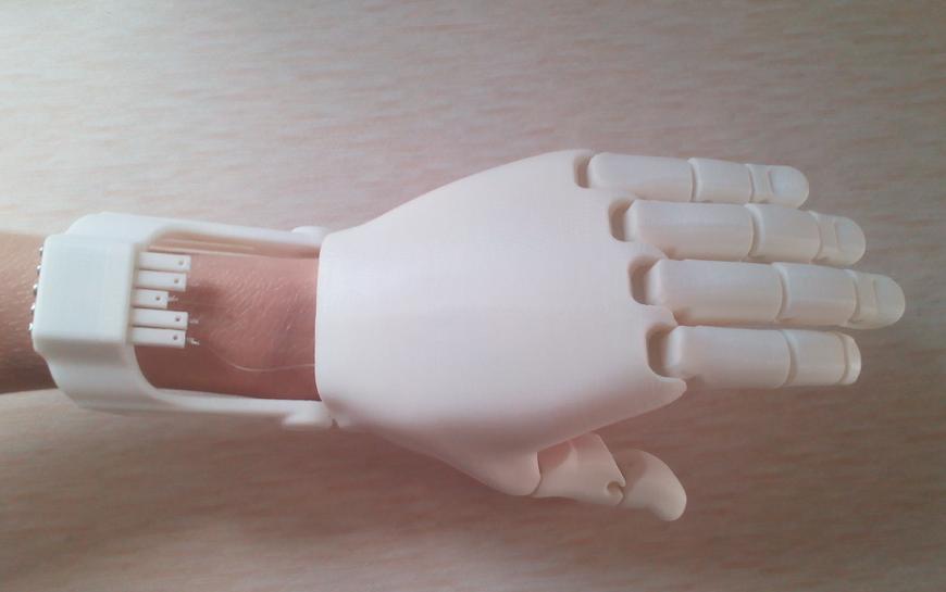 Next Generation of 3D Printed Prosthetic Hands The FlexyHand 2