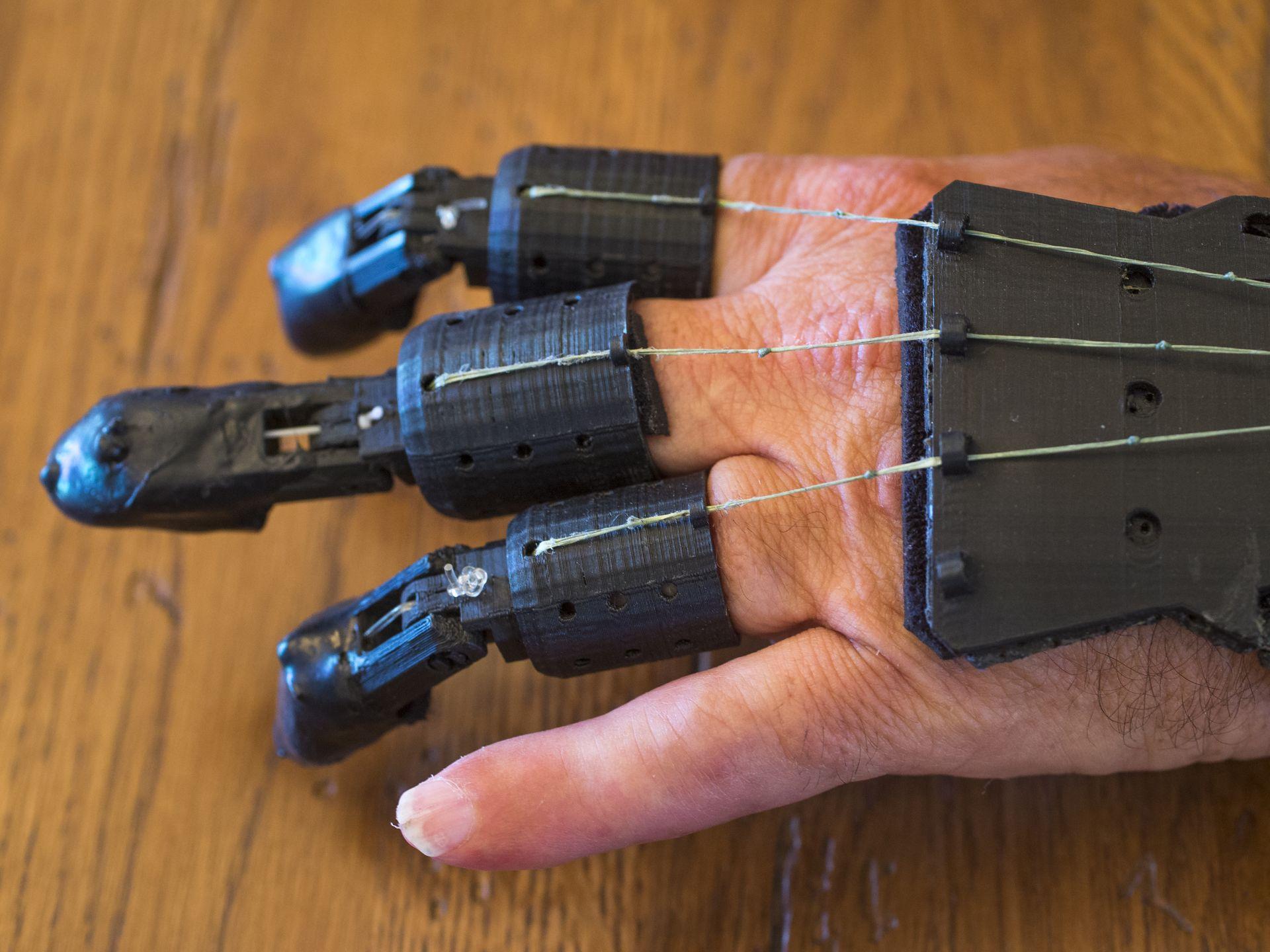 3d Printed Prosthetic Finger Best Cheap