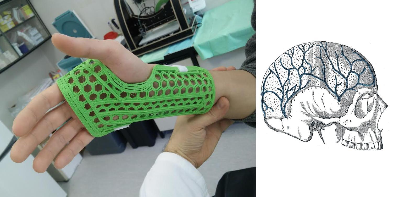 WASP Teams With Rizzoli Institute to Make 3D Printed Conductive Casts