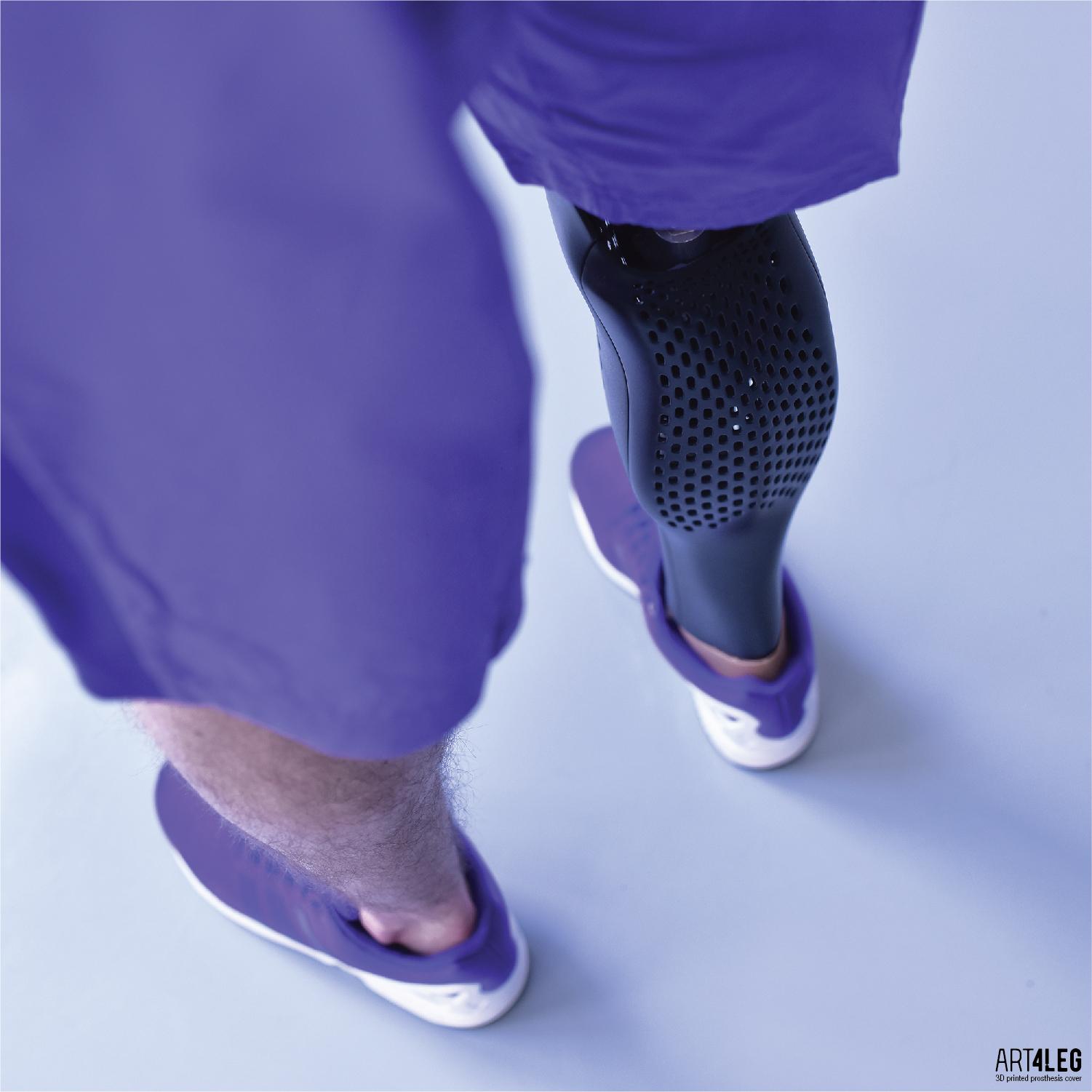 Art4Leg Unveils Custom 3D Printed Prosthetic Leg Covers