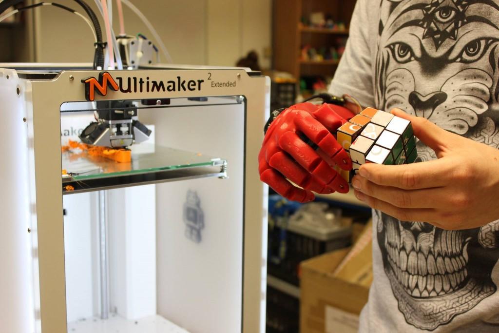 Open Bionics Wins the UK James Dyson Award for 3D Printed Myoelectric