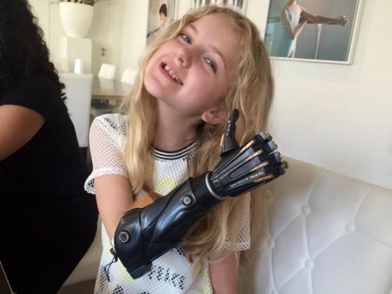World's First Clinical Trial of 3D Printed Bionic Hands for Children