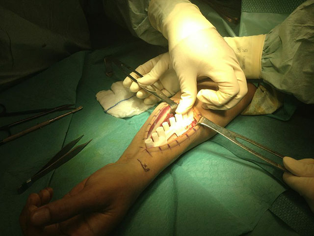 3D Printed Surgical Guides Make Their Malaysian Debut 3D Printing