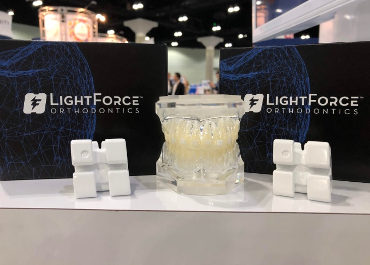LightForce Orthodontics to launch fully customized braces enabled by 3D