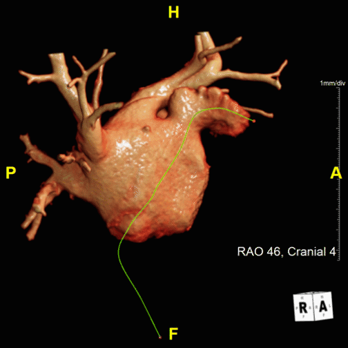Watchman Device 3D and Quantitative Imaging Laboratory