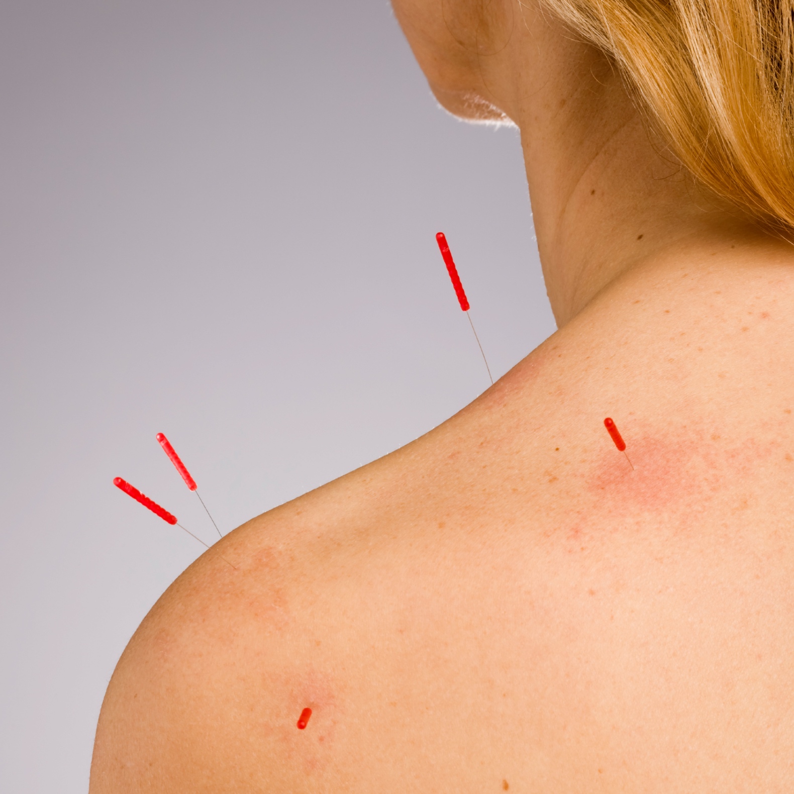 About 3 Harmonies Acupuncture & Asian Medicine