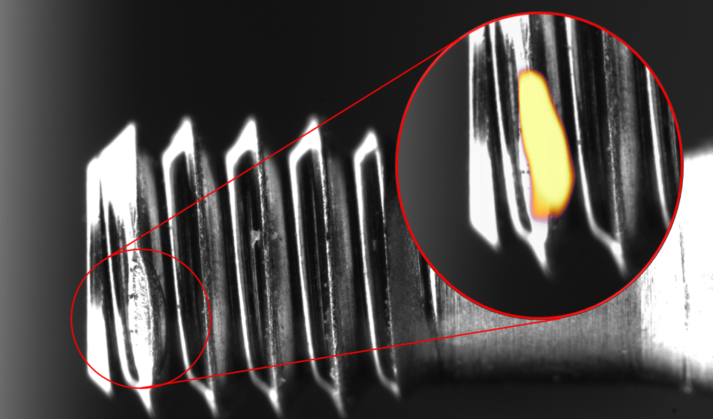 How to Automate Surgical Screws Visual Quality Control A.I. Visual
