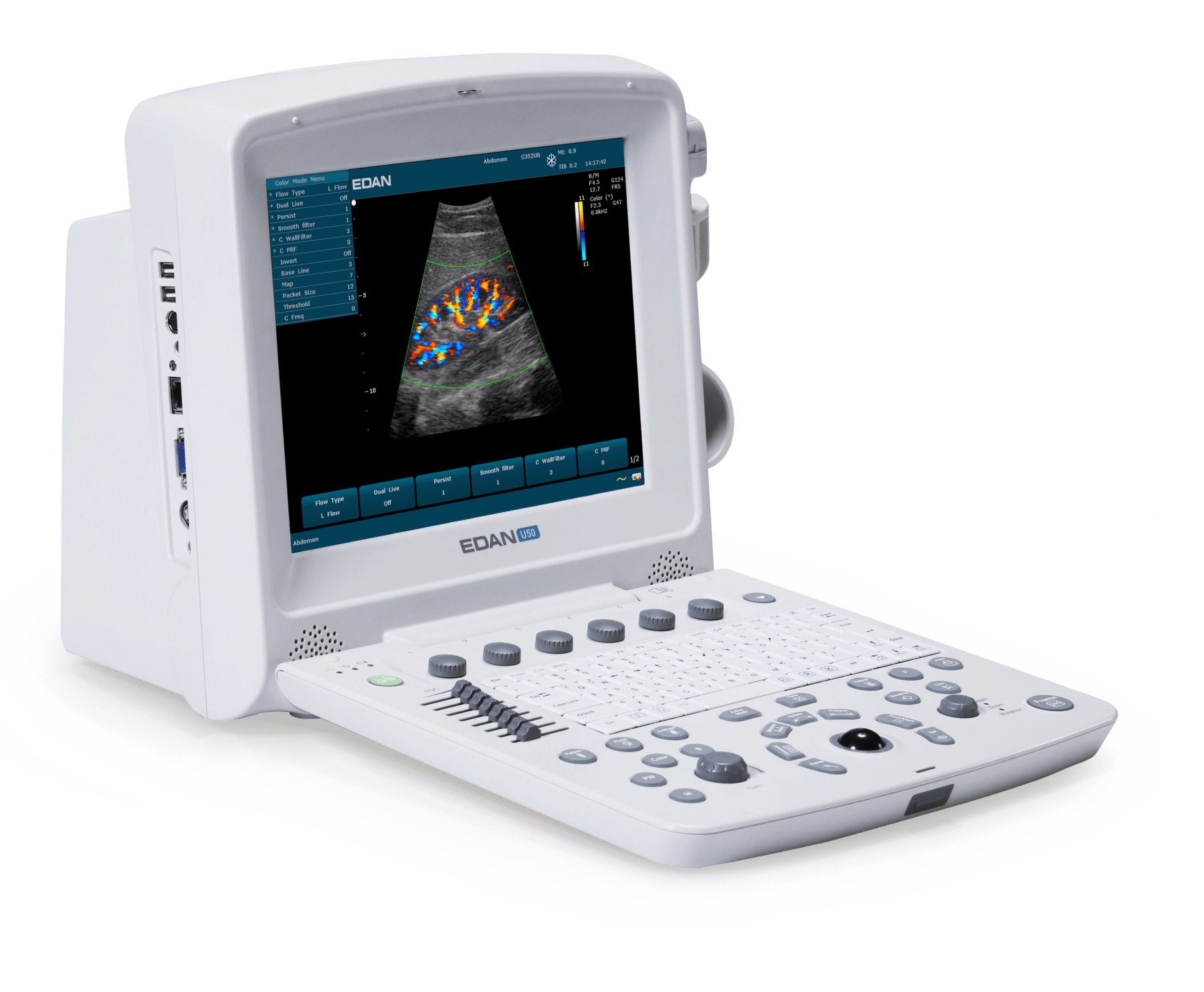 Edan U50 Prime Edition Portable POCUS Point of Care