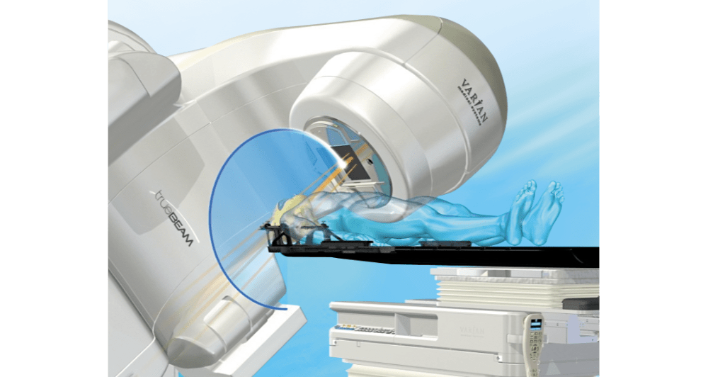 Varian HyperArc Radiotherapy System, For Clinical,Hospital, Treatment
