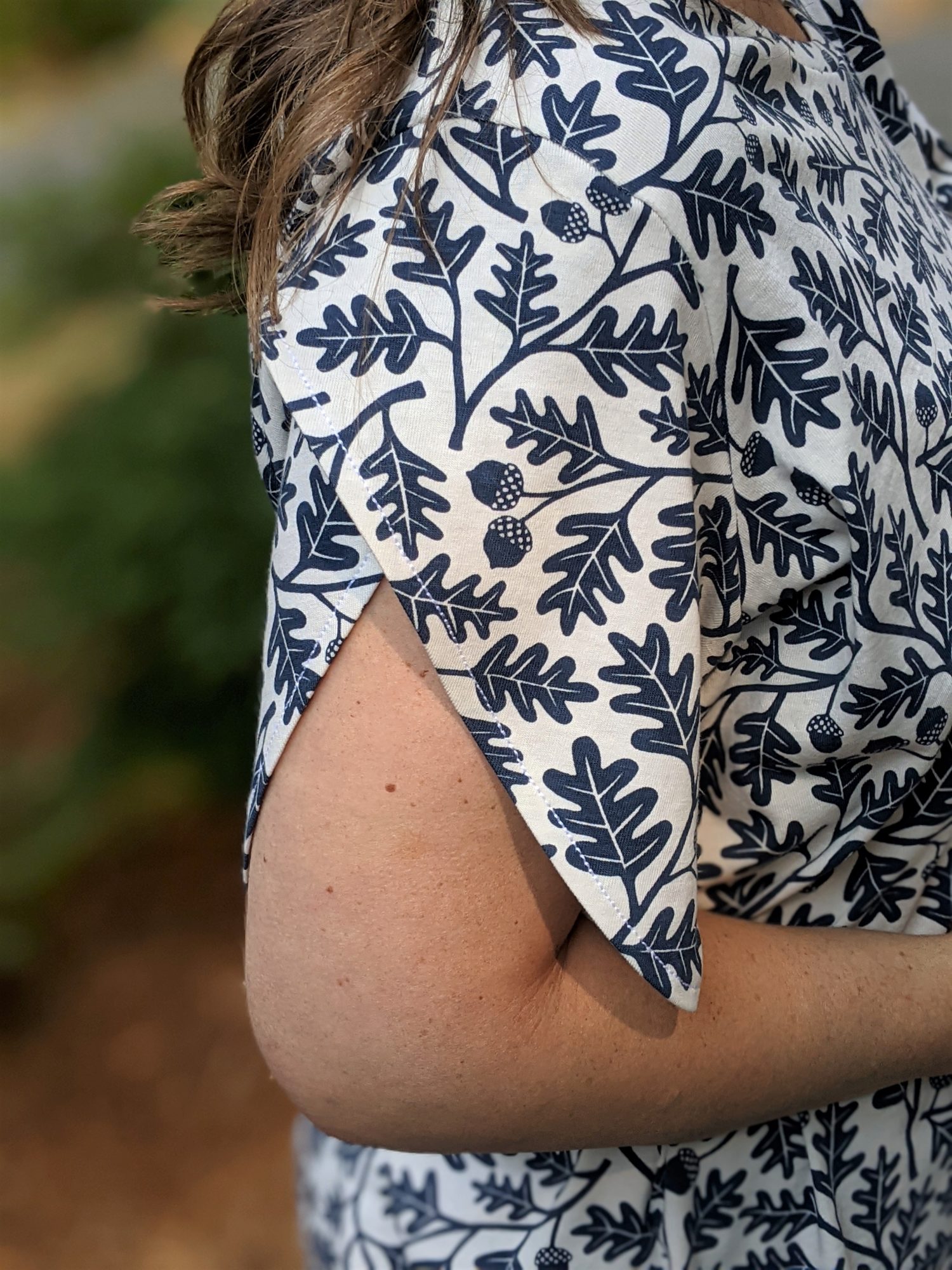 Tulip Sleeve Hack 5 out of 4 Patterns