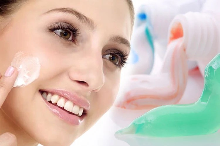 Does Toothpaste Get Rid of Pimples? Get the Surprising Truth Here 7