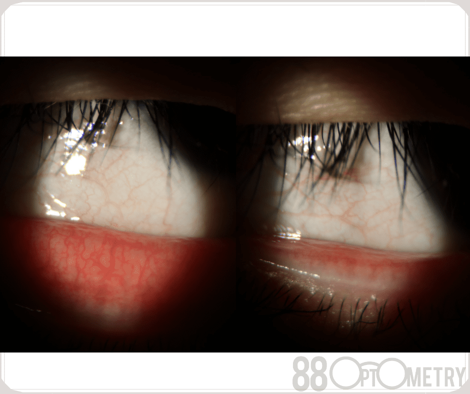 Lydia Tan 88 Optometry