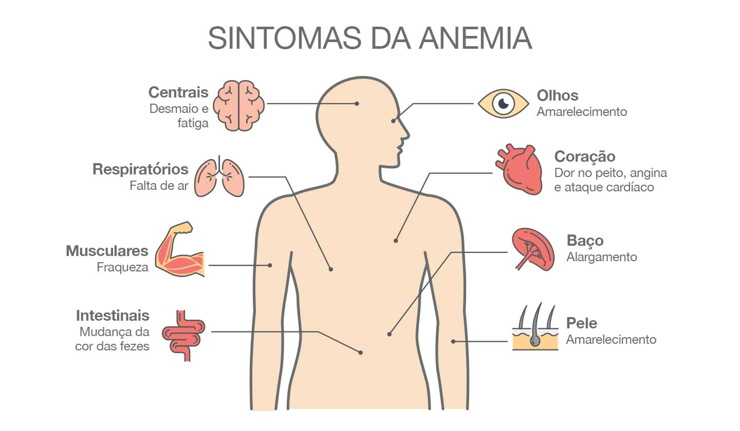 Anemia Ferropénica
