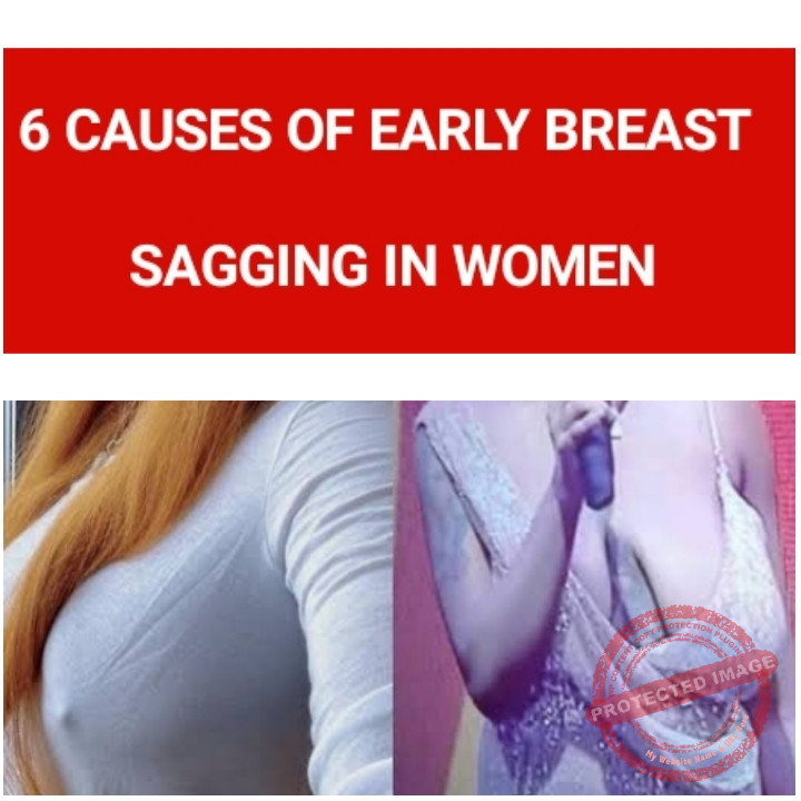 6 Causes of Early Breasts Sagging in Women Saggy Boobs in Women