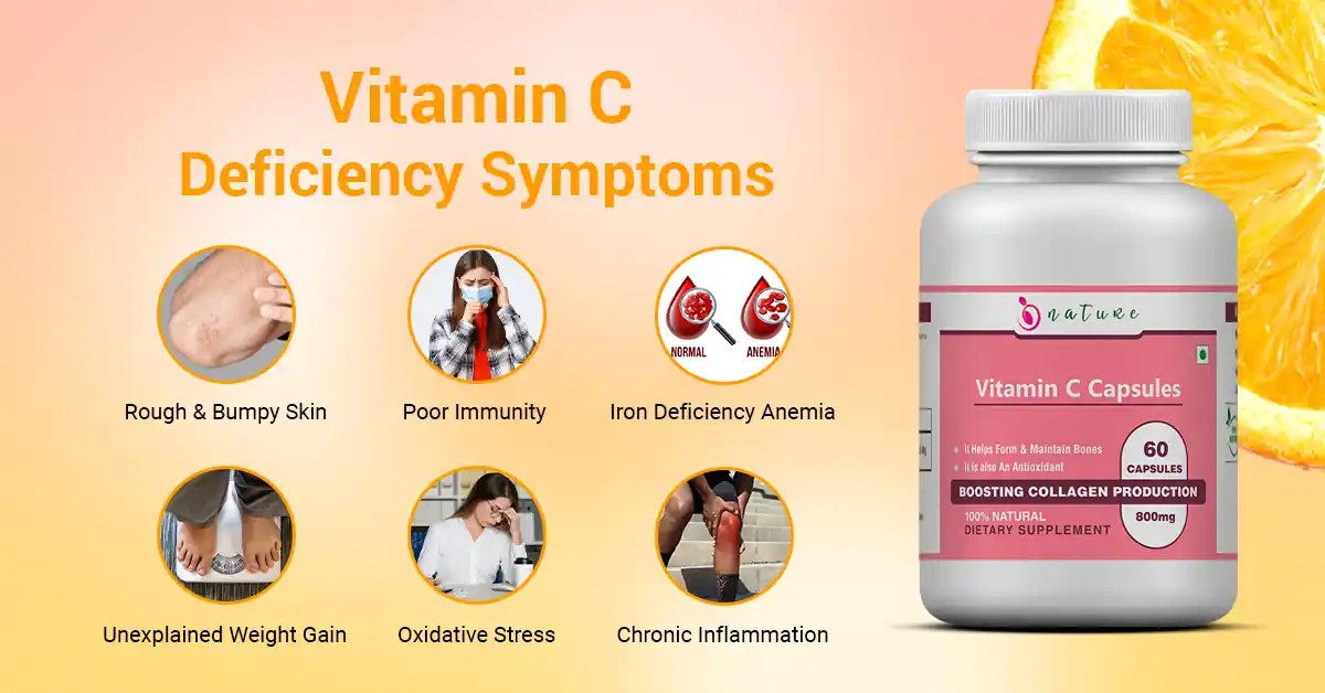 Most Common Vitamin C Deficiency Symptoms And How To Fix Them.