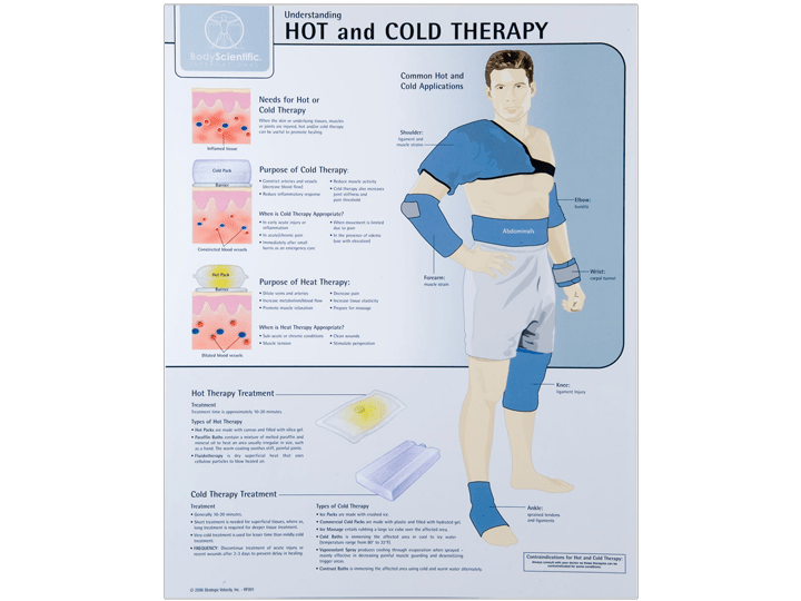 Anatomical Chart Hot & Cold Therapy A1 Medical Integration