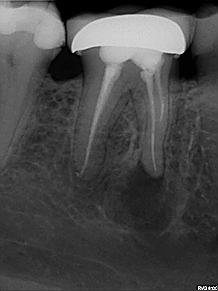 endosurgery1 A2 Endodontics