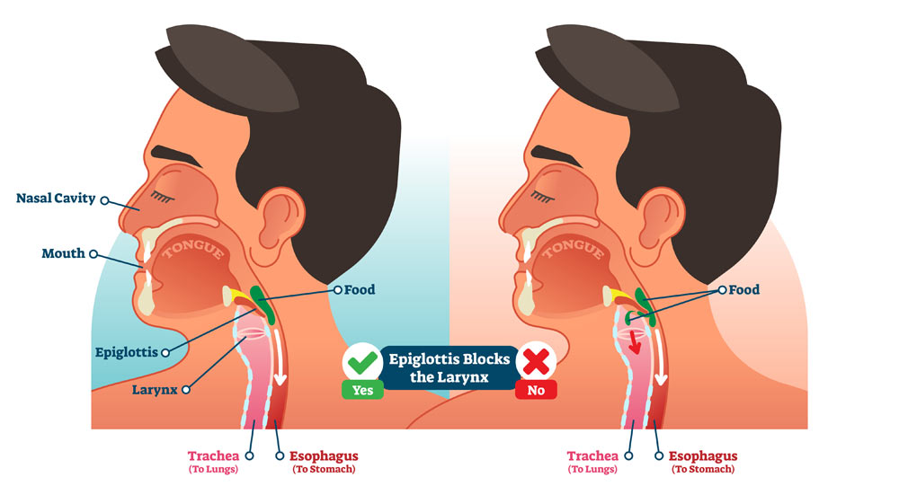 Throat, Swallowing and Voice Disorders Annapolis and Severna Park, MD