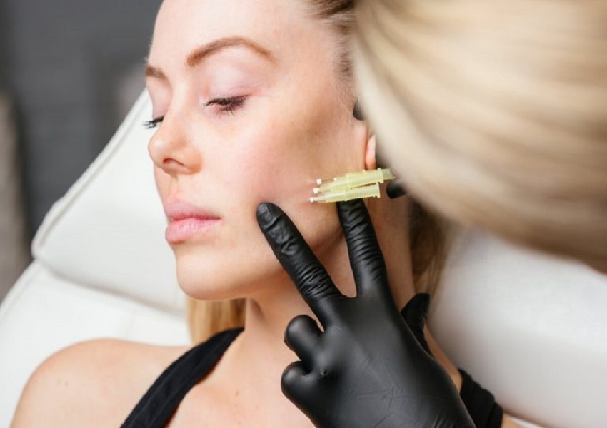 Thread Lift Treatment in Bangalore Aarna Clinic