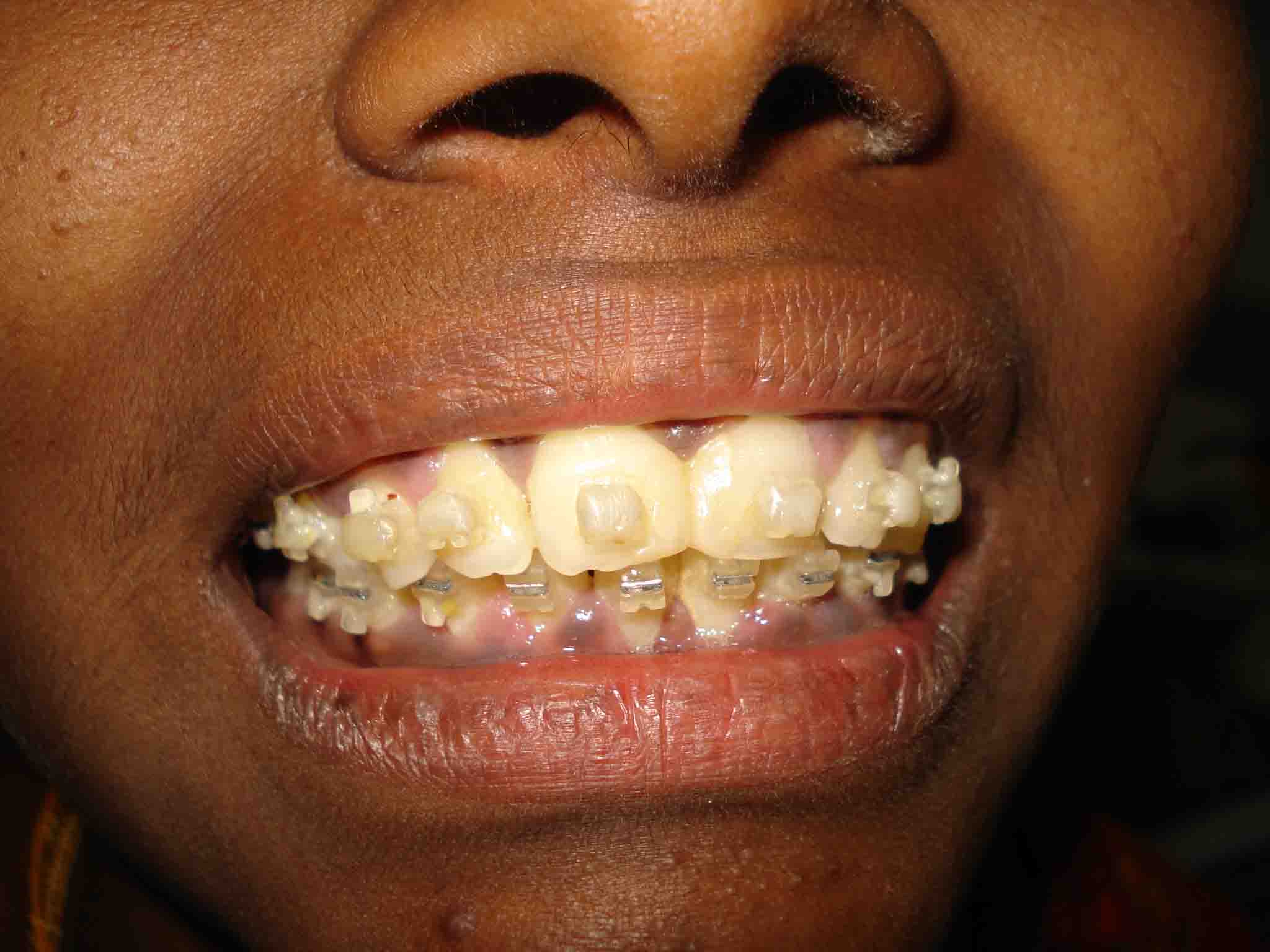 Orthodontics & Dentofacial Dentistry (Clip) AASASTHA Dental Clinic