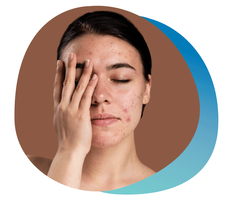 Dermoabrasión Tratamiento estético facial en Vitoria