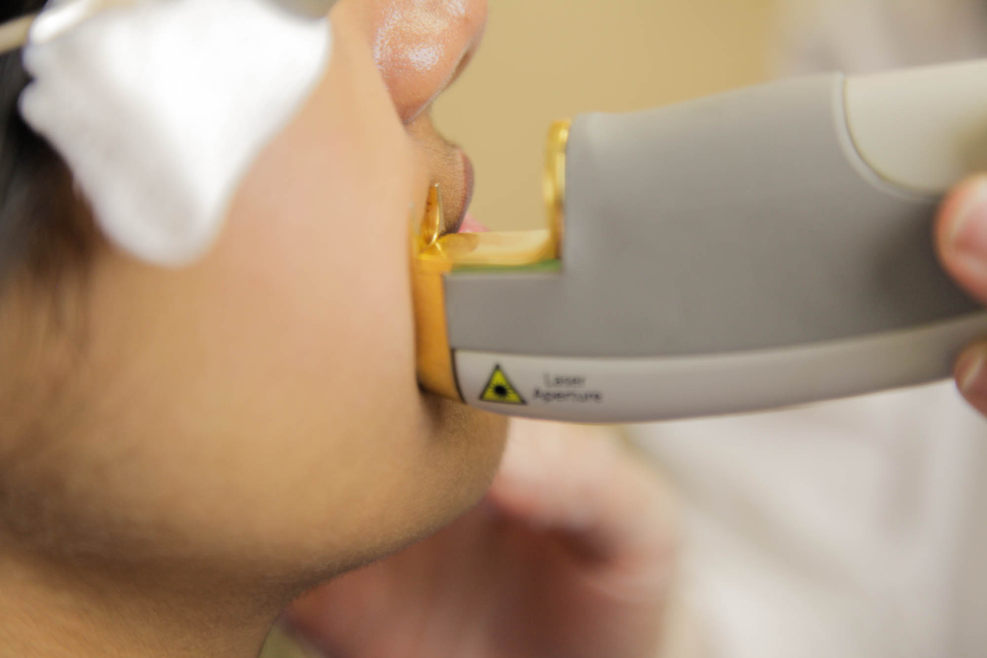 laser hair removal milford ct Raguel Allman