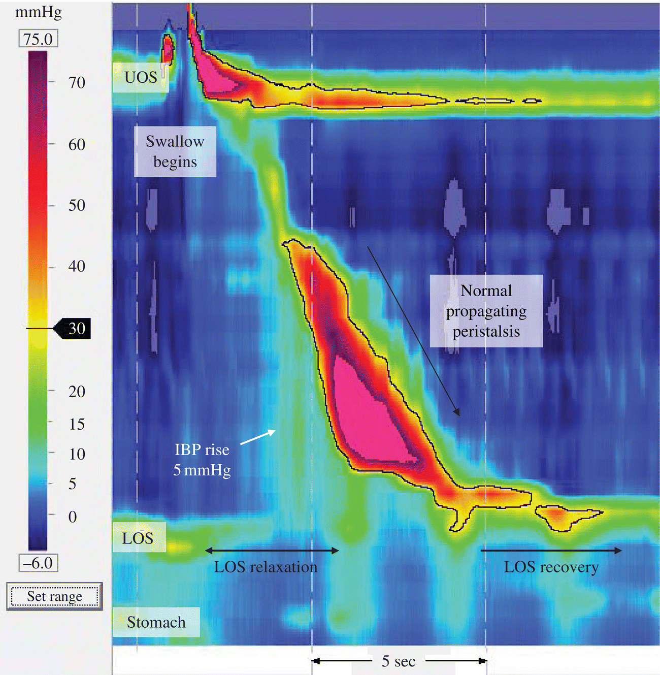 Physiology and function of the oesophagus | Abdominal Key