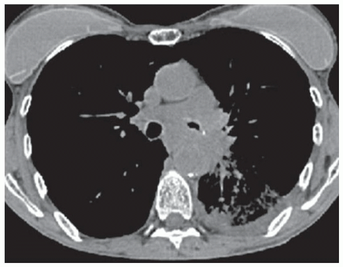 Online Chapter 1 Abdominal Key