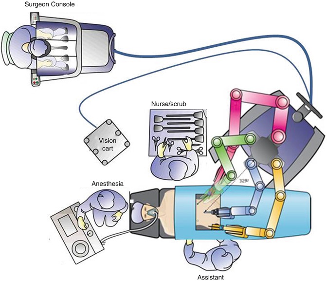 RoboticAssisted Laparoscopic Total Abdominal Hysterectomy Code at