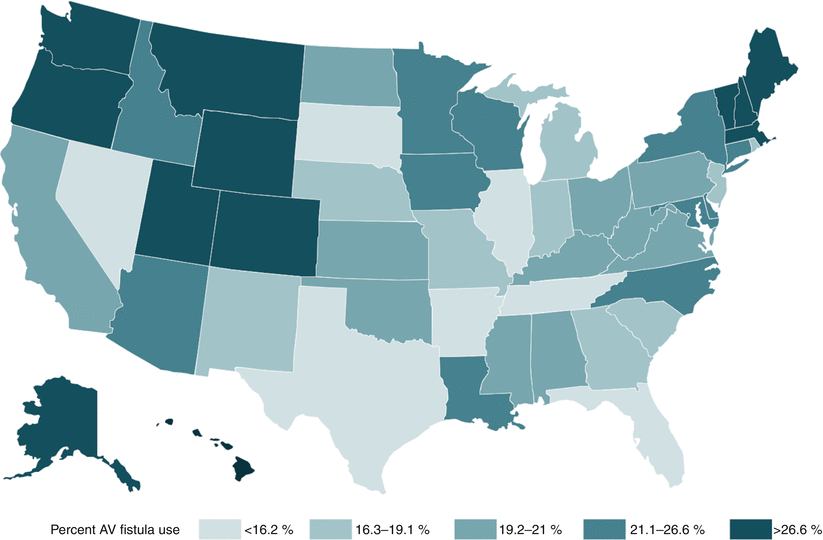 The Current State of Hemodialysis Access and Dialysis Access