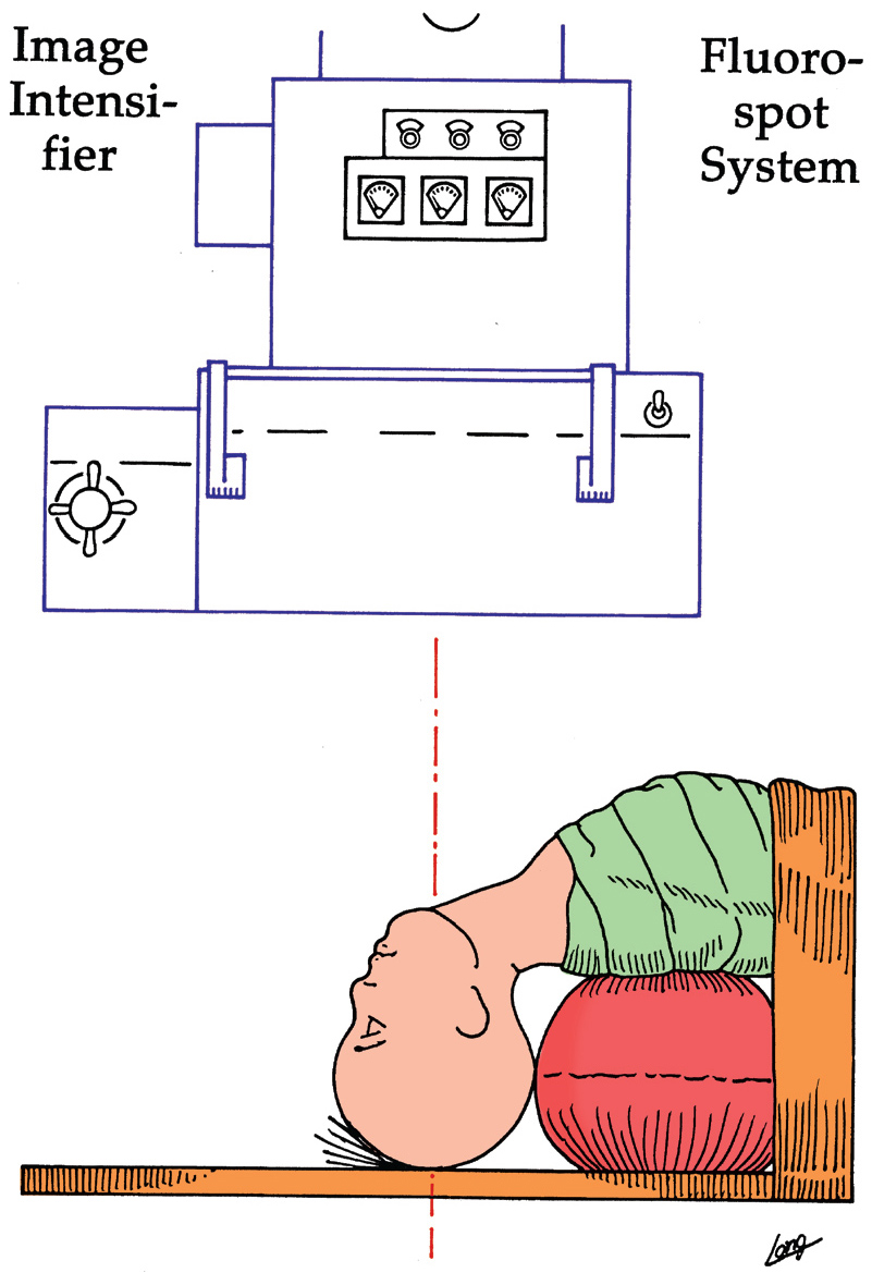 Diagnosis and Tests of Function | Abdominal Key